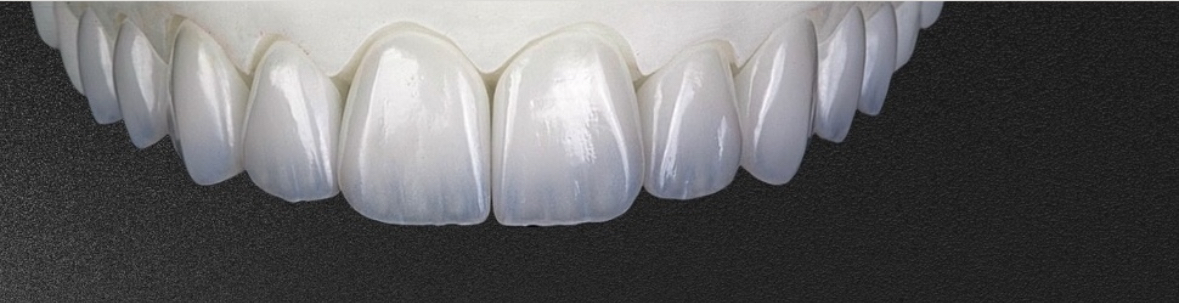 Lentes de Contato Dentárias